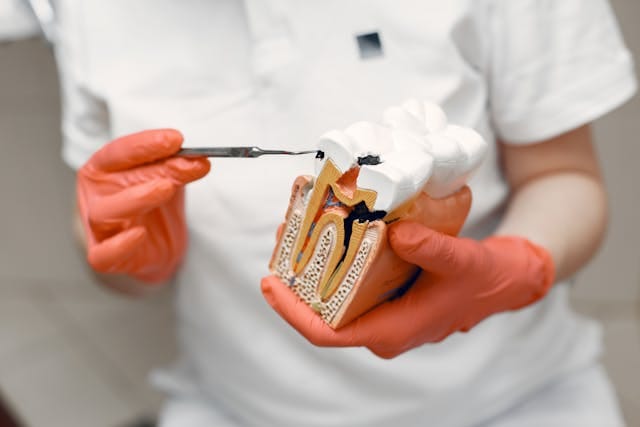 bone grafting