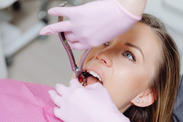 tooth extraction