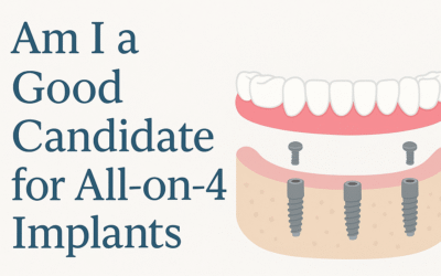 Am I a Good Candidate for All-on-4 Implants?